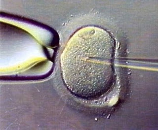 Catholic church position on sperm donation concurrence think Catholic church position on sperm donation sense